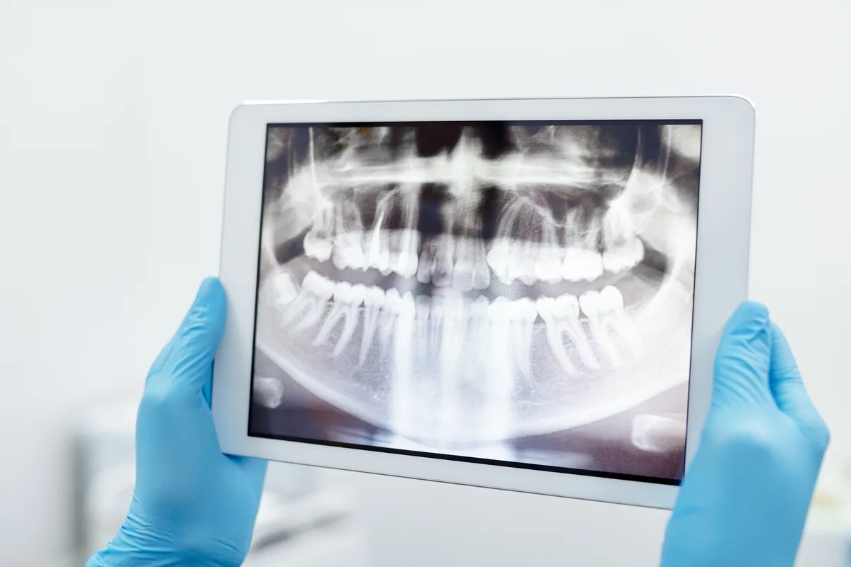 Radiologia digital